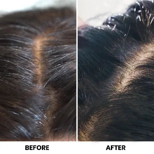 Before & After